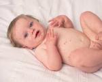 Как лечить аллергию у грудничка Можно ли купать ребенка при аллергической сыпи